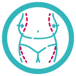 Postoperatorio - Liposucción