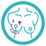 Postoperatorios-Mamoplastia